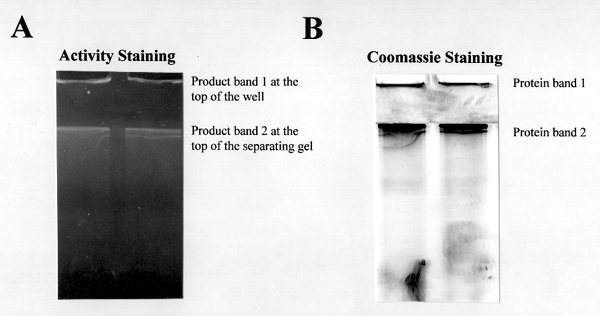 Native+page+gel+electrophoresis